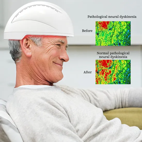 Máquina de terapia de luz infravermelha para capacete de neuroestimulação Suyzeko para terapia de fotobiomodulação
